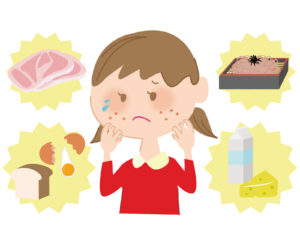 腸活とアレルギーについて、日本人の3人に1人が何らかのアレルギーを持っている？