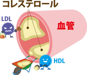 腸活とコレステロール。善玉コレステロールについて。